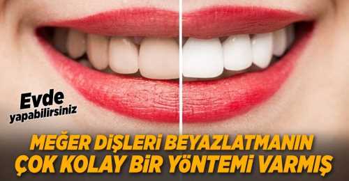 Dişleri Beyazlatmada Kolay Yol  