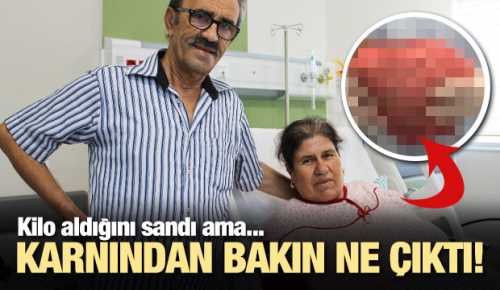 Karnından 7 kiloluk kitle çıktı!