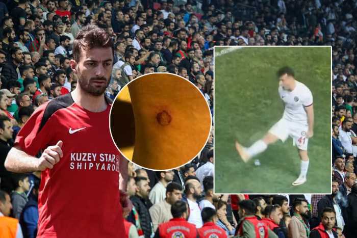 Çorum FK'den Amed Maçı Sonrası Sağduyu Çağrısı!