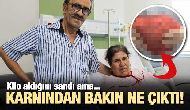 Karnından 7 kiloluk kitle çıktı!